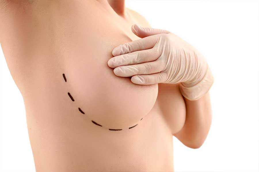 otras-cirugias-de-mama-unidad-mujer-recoletas Otras cirugías de mama. Unidad de la Mujer Recoletas Salud